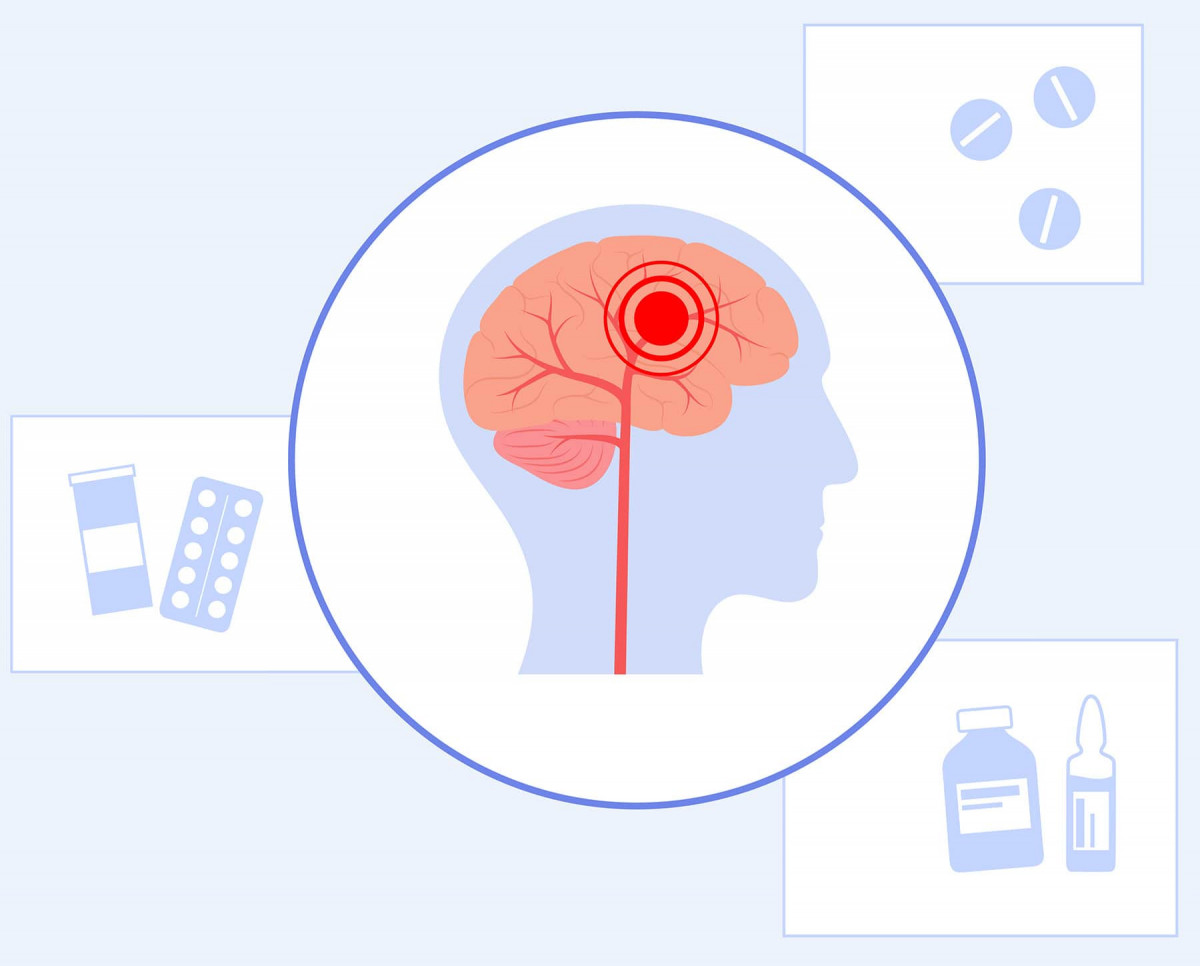 Енцефалопатія: причини, симптоми та лікування