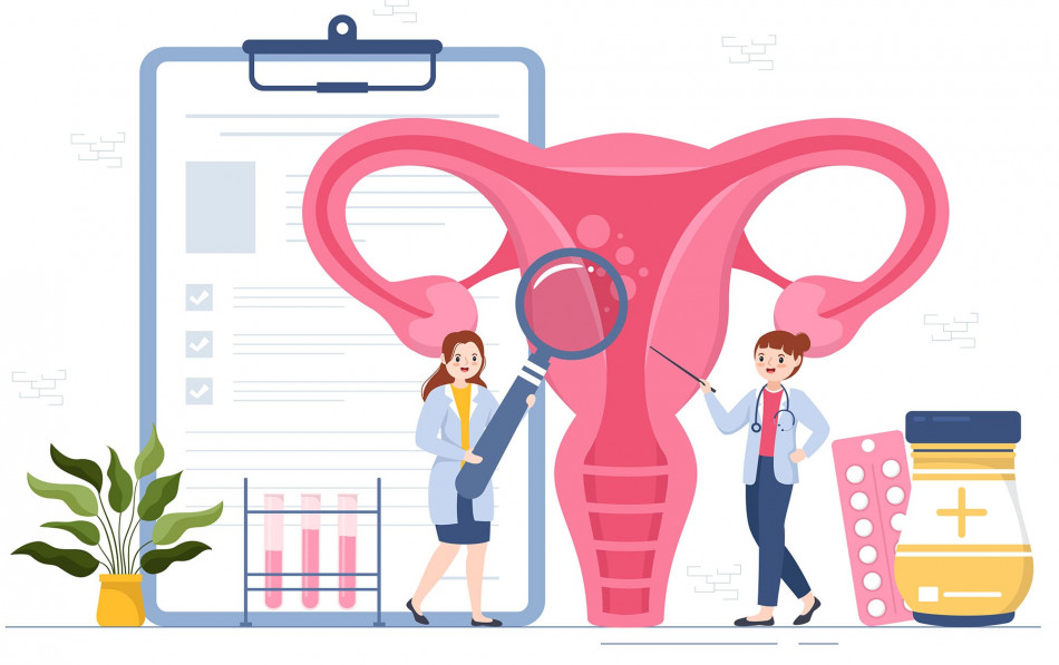 Подготовка к конизации шейки матки